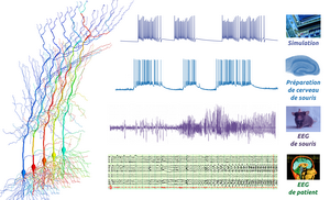 Epilepsie une avancée majeure