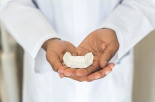 Empreinte dentaire pour prothèse dentaire