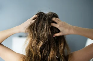 état des cheveux